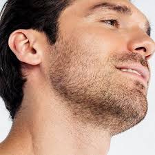 Discover Dubai's Premier Beard Hair Transplant Services