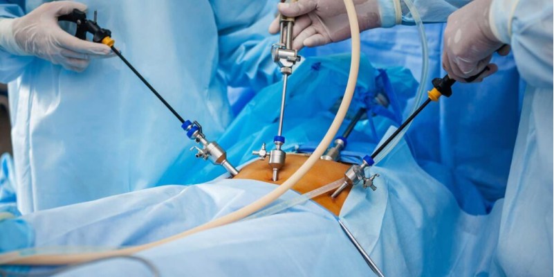 Best Laparoscopic Surgery in Indore | Dr. Rakesh Dhupia Jain